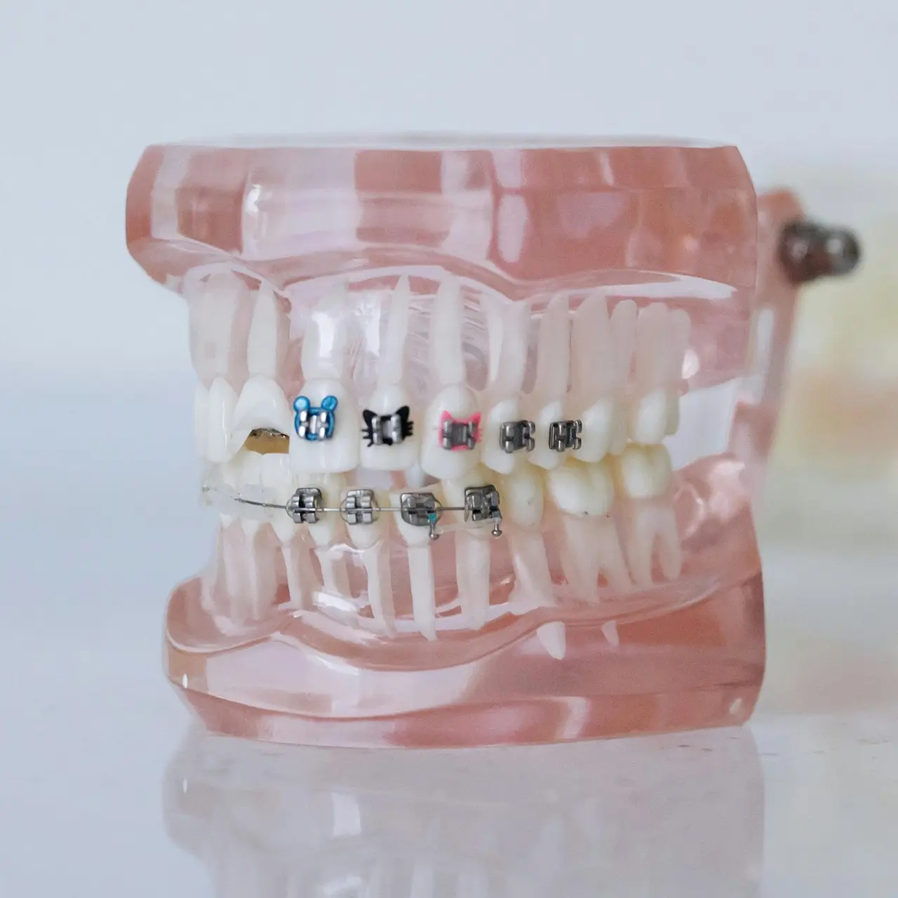 An invisalign photo