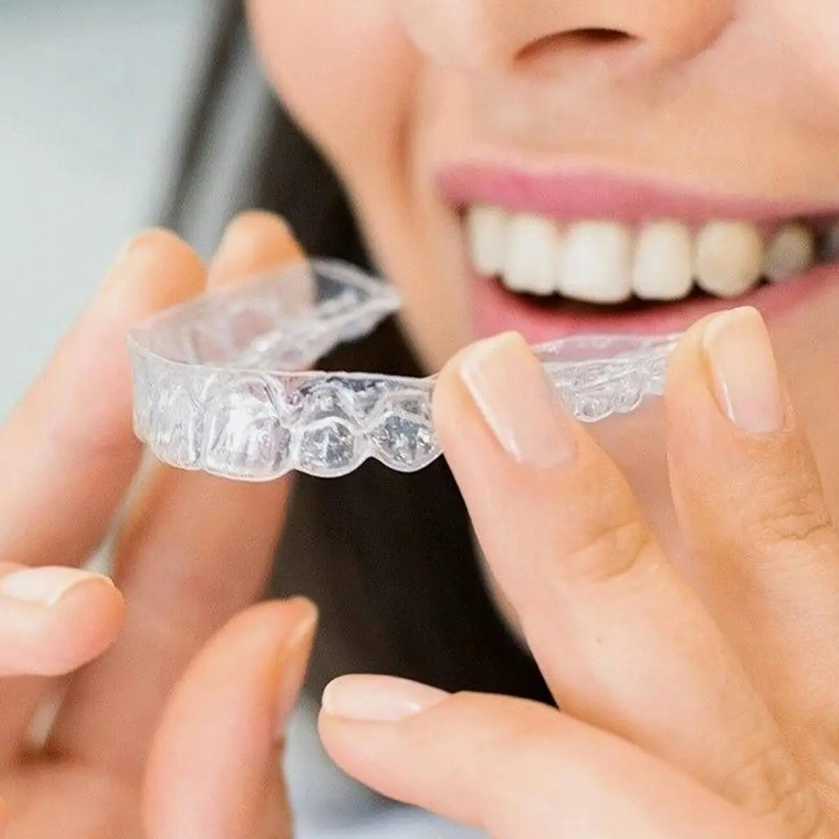 Teetch braces photo