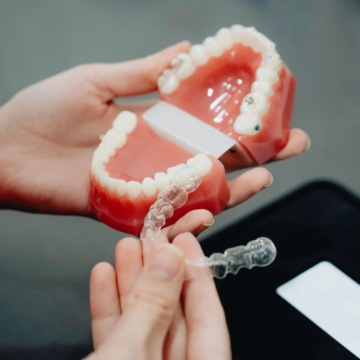An invisalign photo