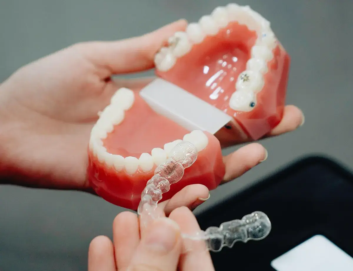 Invisalign